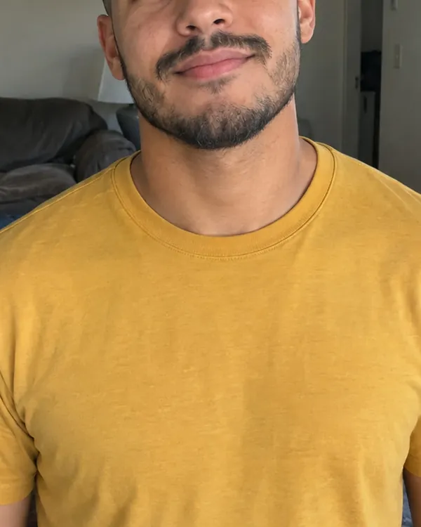 Photo cropped at the nose, so the top of the face is missing